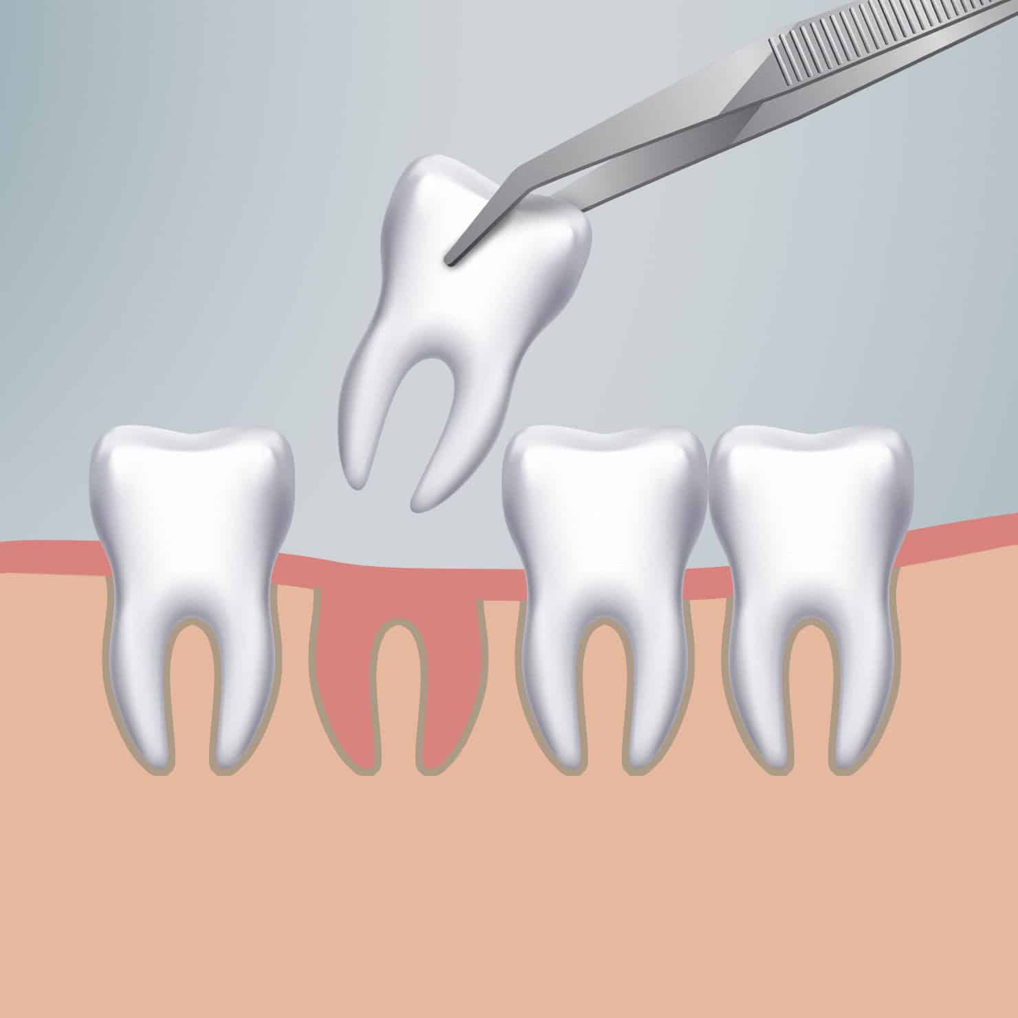 procedure